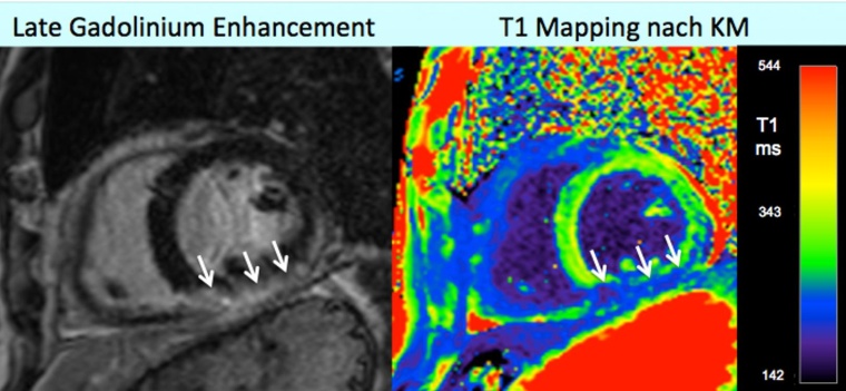 Abb. 3: Gleicher Patient wie in Abb. 2, weiteres siehe Haupttext.