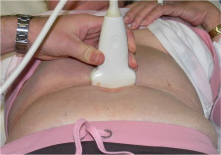 Abb. 2: Sonografie der abdominalen Aorta