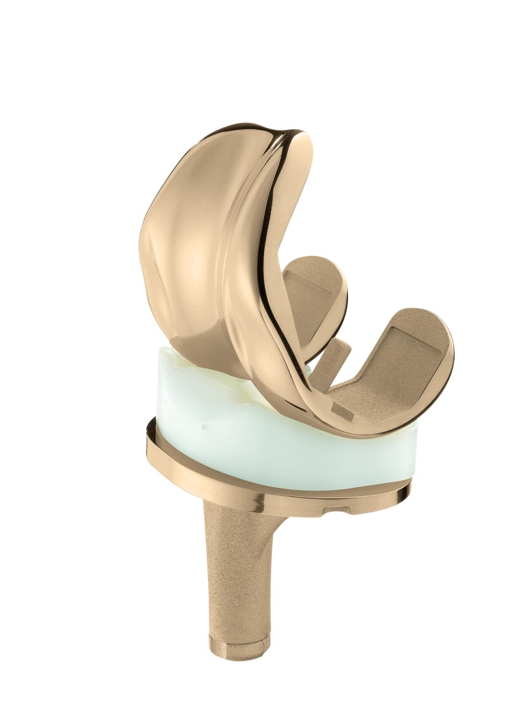 Abb. 2: Advanced-Surface-Beschichtung auf einer Knieendoprothese.