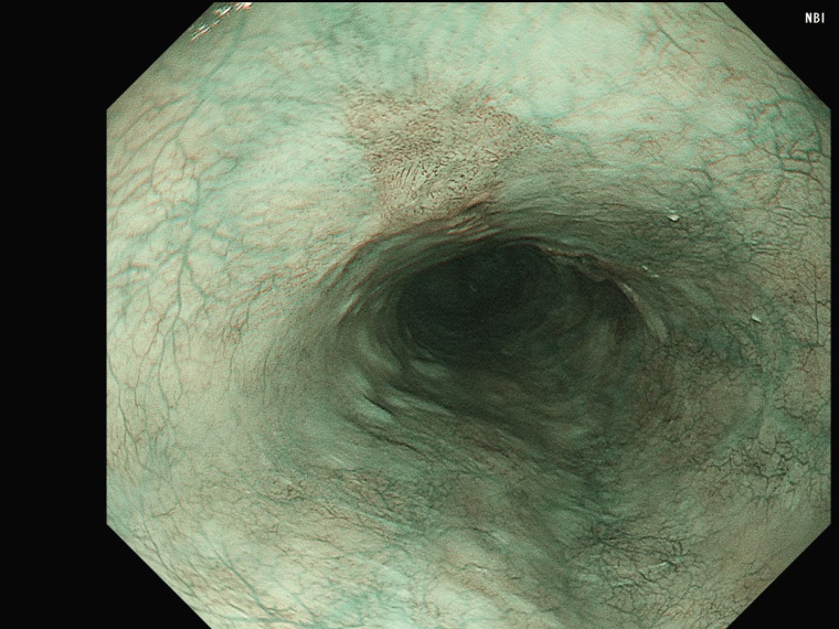 Olympus präsentierte auf dem Jahreskongress der Deutschen Gesellschaft für...