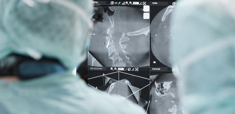 Intraoperative Bildgebung während des Eingriffs.