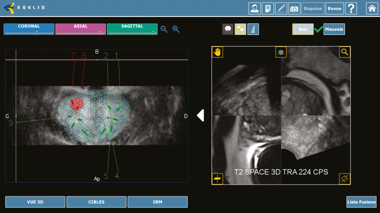 Multiplanare 3D-Anzeige.