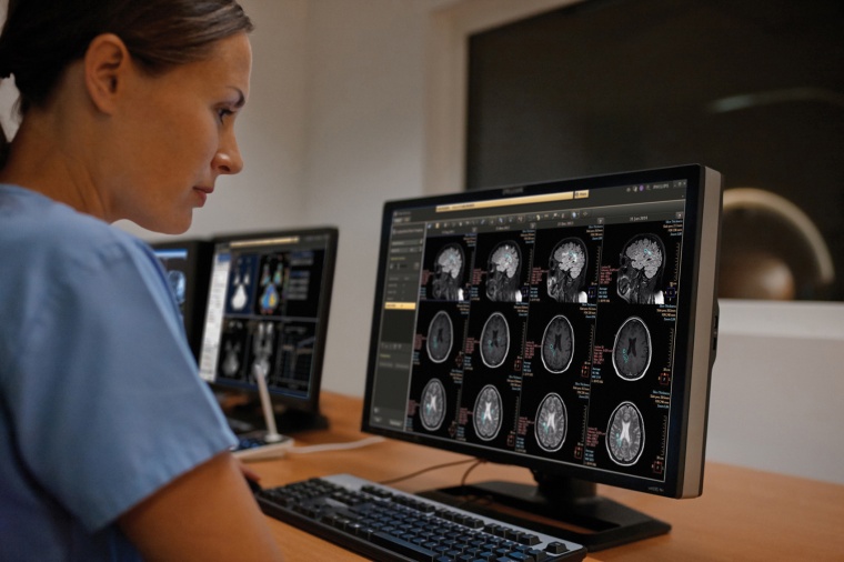 Mensch-Maschine-Kollaborationen werden die Radiologie verändern.