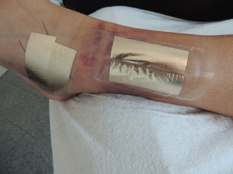 Abb. 3b: Dokumentation der Positionen der aufgetragenen Spezialfolien.