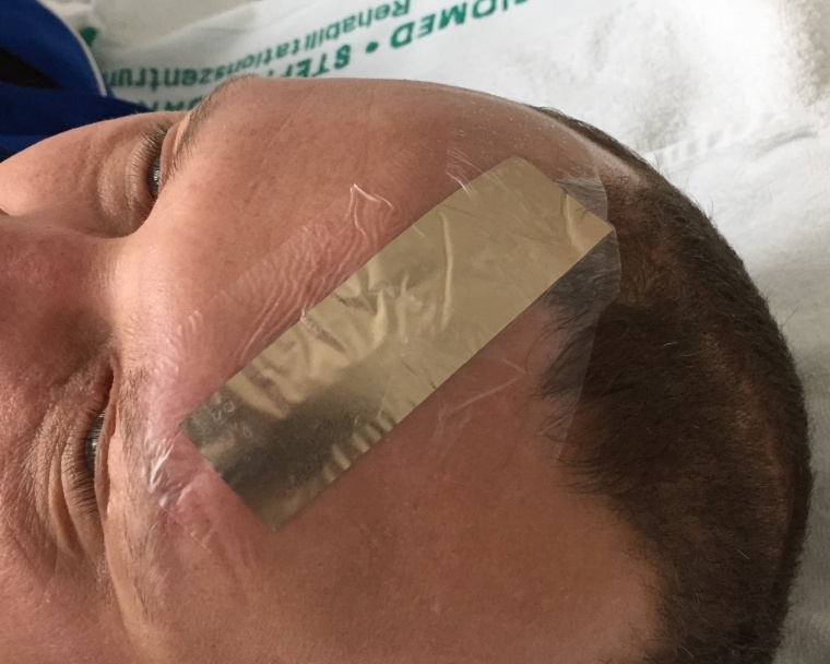 Abb. 4b: Fixierte Spezialfolie nach dem Ziehen der Fäden.