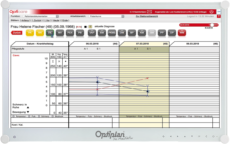 Opticare (Beispiel: Verlaufskurve)