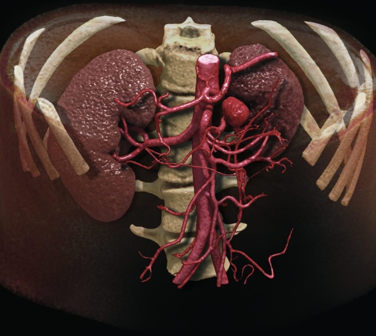 Bilder nach der Rekonstruktion mittels neuer Global Illumination Software von...