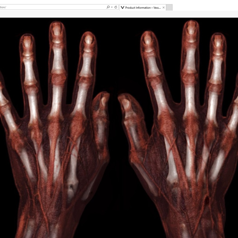 Bilder nach der Rekonstruktion mittels neuer Global Illumination Software von...