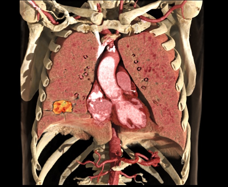 Bilder nach der Rekonstruktion mittels neuer Global Illumination Software von...