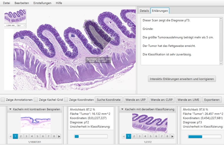 „Mikroskopie“: Mikroskopische Bilder des menschlichen Dickdarms...