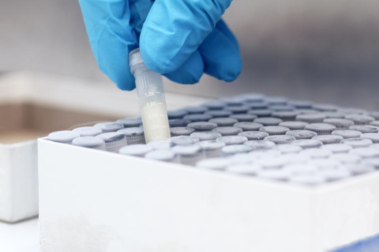 Die aus den Bronchialsekreten der Patientinnen und Patienten gewonnenen Isolate...