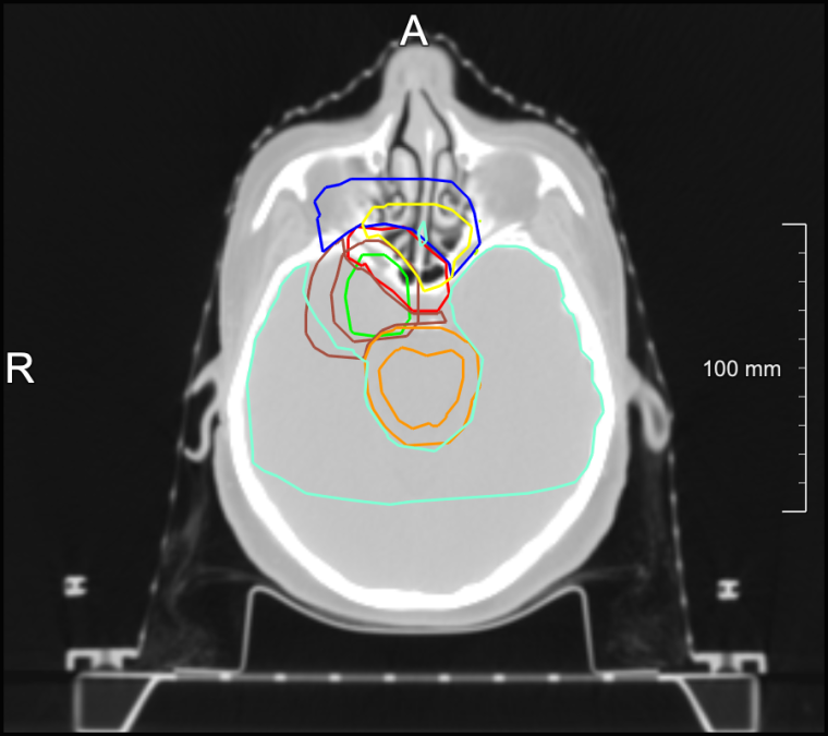 Strahlentherapeuten müssen sicherstellen, dass alle für die...