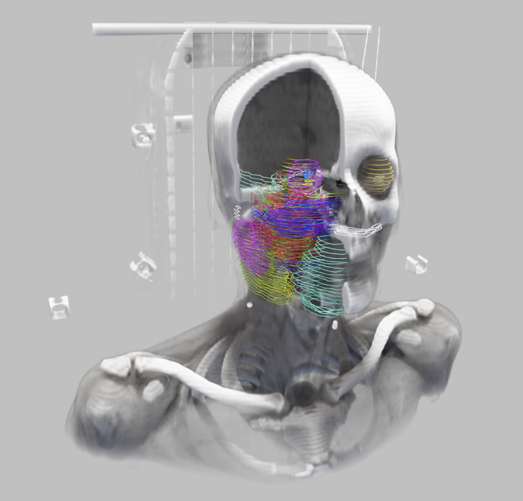 Das mühsame Einzeichnen Hunderter von Konturen auf den Schichten einer...