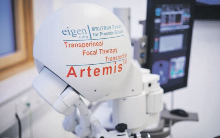 Das Artemis-System zur Entnahme von Gewebeproben ermöglicht eine semirobotisch...