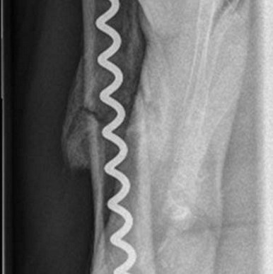 Röntgenbild nach zwölf Wochen mit deutlicher Kallusbildung und ohne...