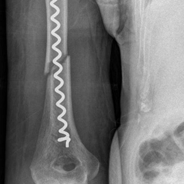 Röntgenbild nach Versorgung Foto: Krasnici