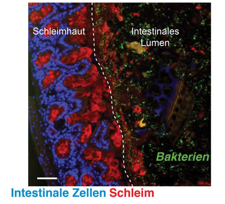 Billionen von Darmbakterien (grün) beeinflussen nicht nur das Immunsystem...