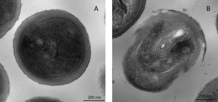 Elektronenrastermikroskop Aufnahmen von Methicillin-resistentem Staphylococcus...