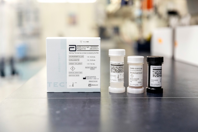 SARS-CoV-2 IgG. Foto: Abbott