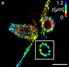 (a) 3D Ex-dSTORM von 3,2-fach expandierten Zentriolen. Messbalken 1 Mikrometer....