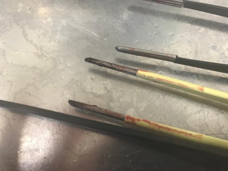 Vorher-Nachher-Vergleich: HF-Instrumente vor der Reinigung mit dem...