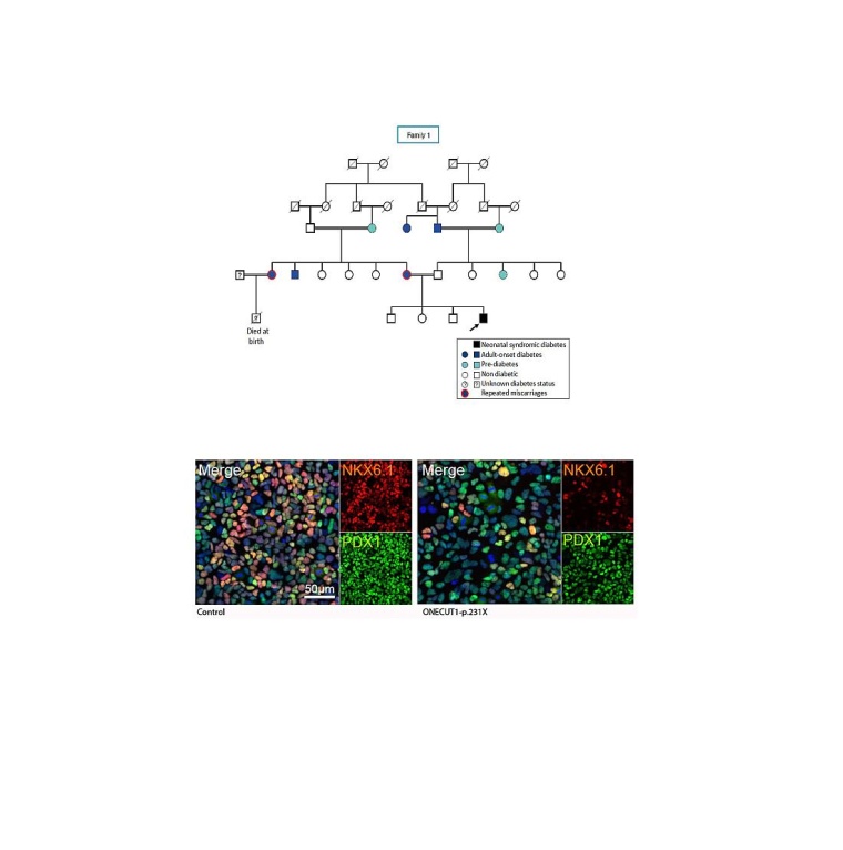 Stammbaum der Indexfamilie, welcher zur Identifikation der ONECUT1-p.231X...
