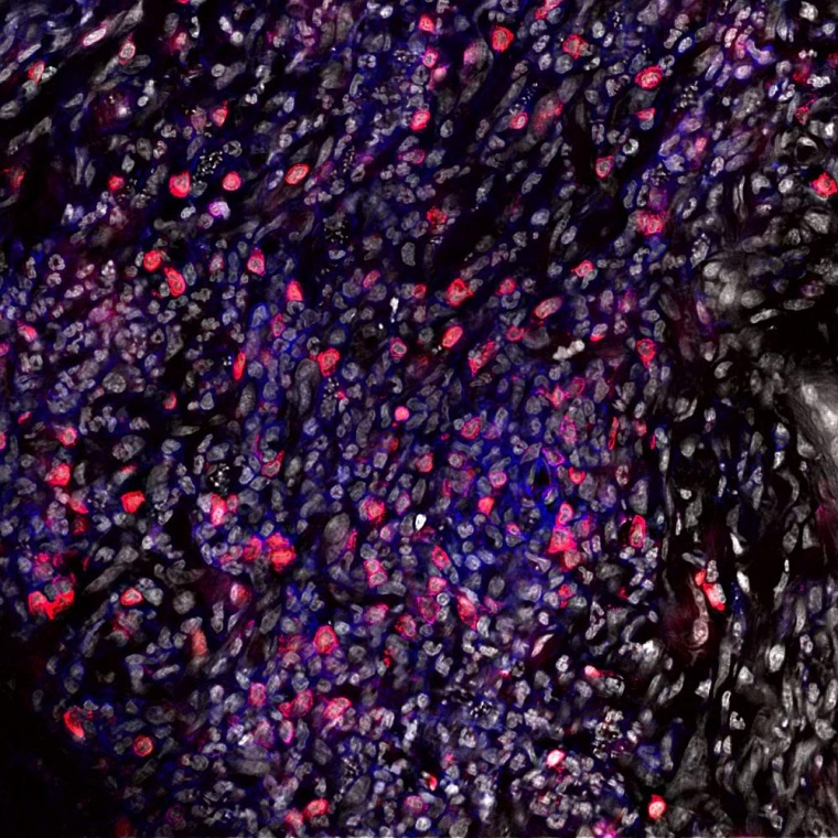 Mikroskopieaufnahme einer Infektionsstelle von Leishmania major in der Haut....