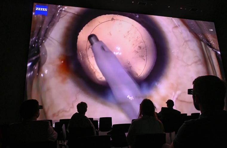 3D-Aufzeichnung OP Grauer Star. Foto: JKU 