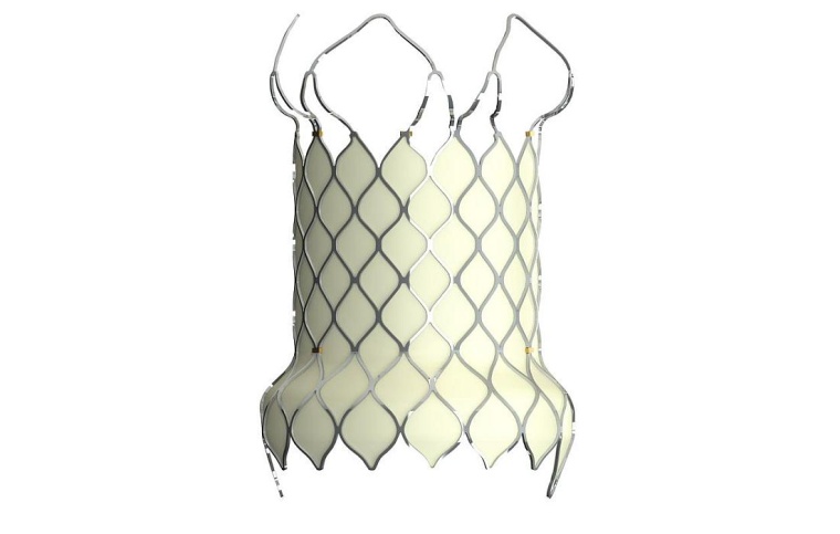 Innovative künstliche Pulmonalklappe VenusP-Ventilsystem. Foto: Venus Medtech