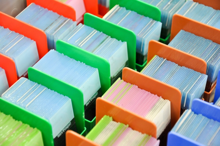 Glasobjektträger mit Gewebeproben Foto: Dr. Senckenbergische Institut für...