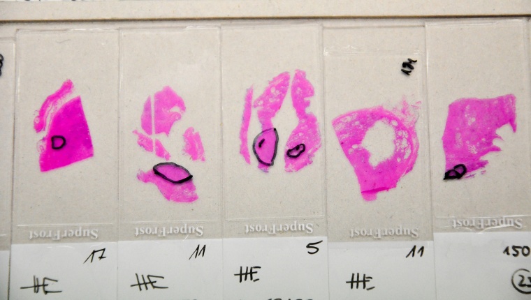 Glasobjektträger mit Gewebeproben Foto: Dr. Senckenbergische Institut für...