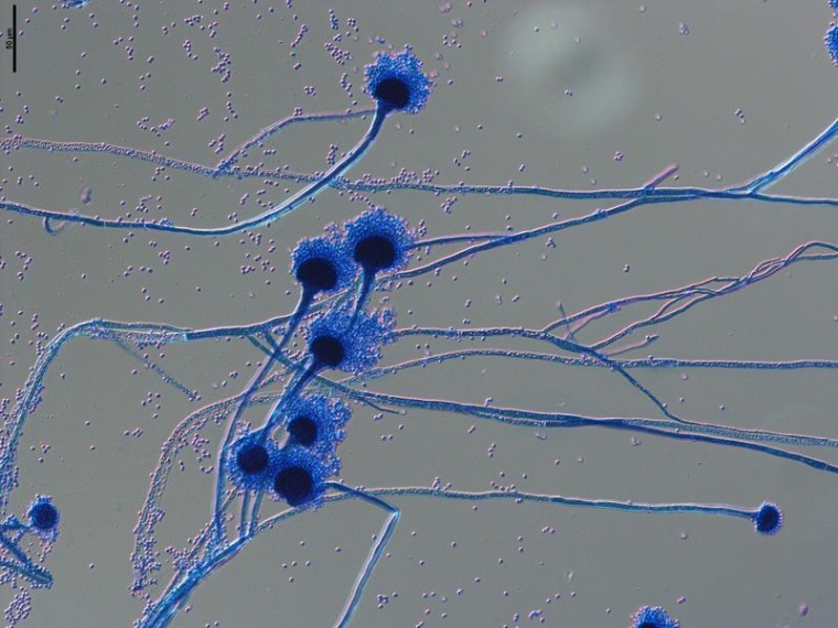 Aspergillus fumigatus ist ein Pilz, der in der Umwelt häufig vorkommt. Bei...
