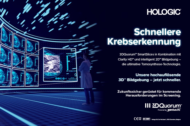 Foto: Hologic
