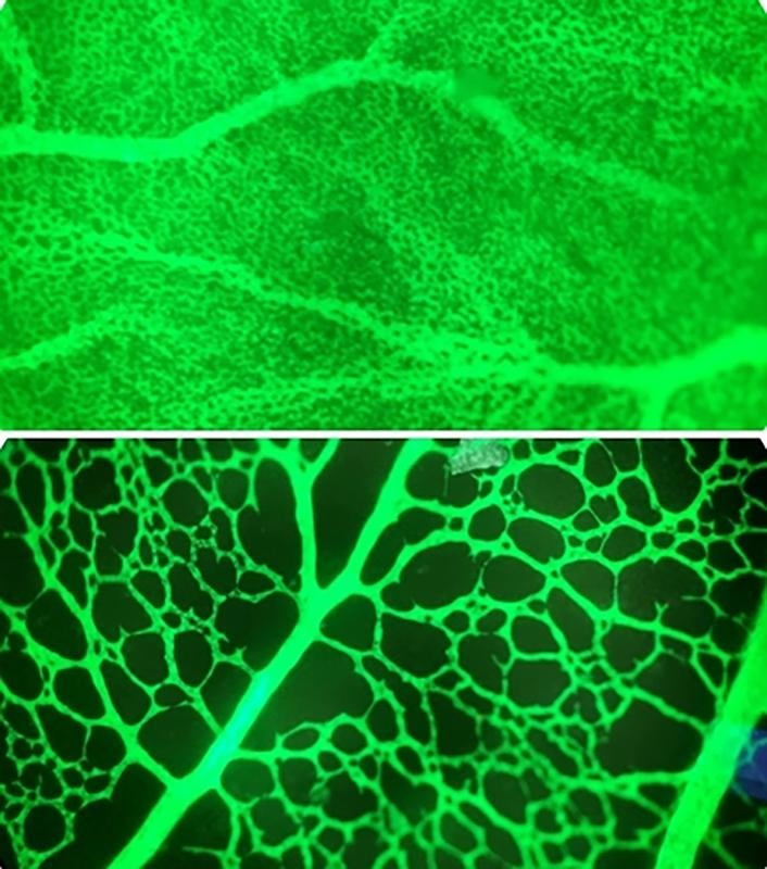 Gelangen Nanopartikel während der Schwangerschaft in die Plazenta, wird die...