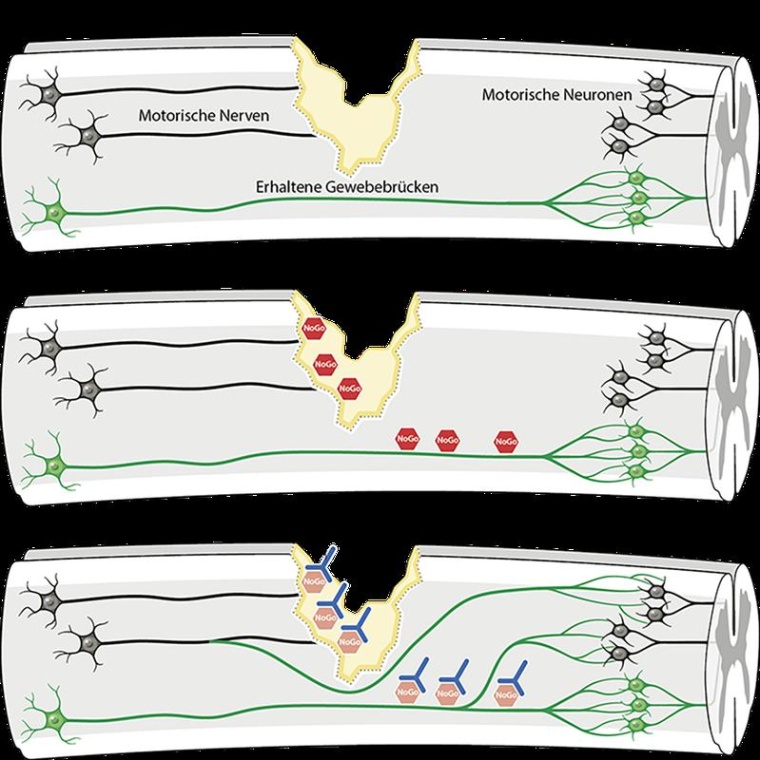 Nervenverbindungen wachsen in Rückenmarksgewebe nach. Foto:...