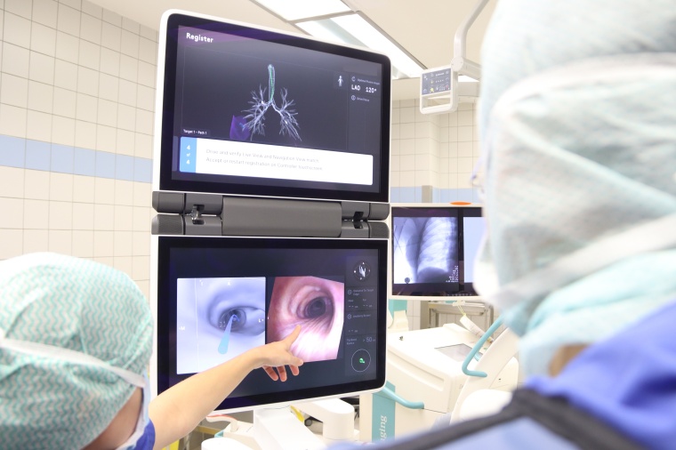 Mit dem ION-System können mithilfe von KI sehr kleine, auch in der Peripherie...