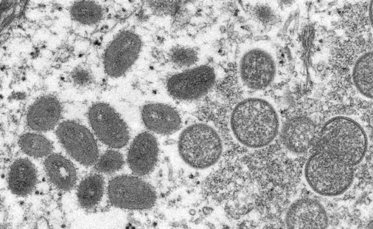 MPox-Virus Foto: CDC / Cynthia S. Goldsmith, Russell Regnery