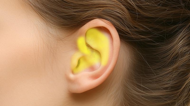 Versorgungsgebiet des Vagusnervs an der äußeren Ohrmuschel Foto: Hochschule...