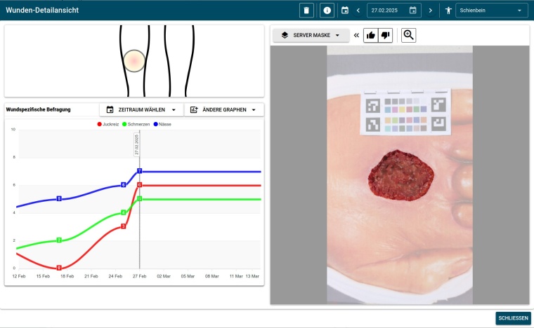 Mit der Wunderkint-App können Patient*innen regelmäßig ihre Wunde...