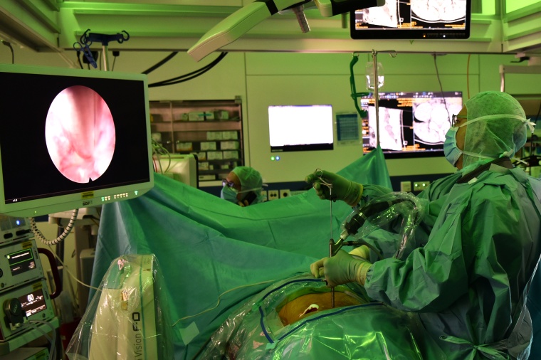 Bei einem endoskopischen Eingriff an der Wirbelsäule sieht der Neurochirurg...