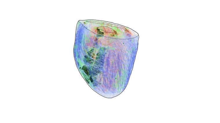 3D-Rekonstruktion eines Herzens: Die Muskelzellen sind faserartig angeordnet...