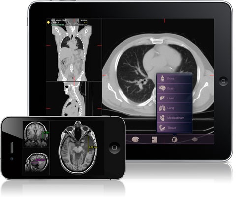 Die mobile Radiologie-Applikation MIM Mobile für das iPad und iPhone von Apple...