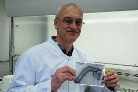 UKM-Virologe Prof. Dr. Joachim Kühn mit dem Beweisfoto: Unter dem...