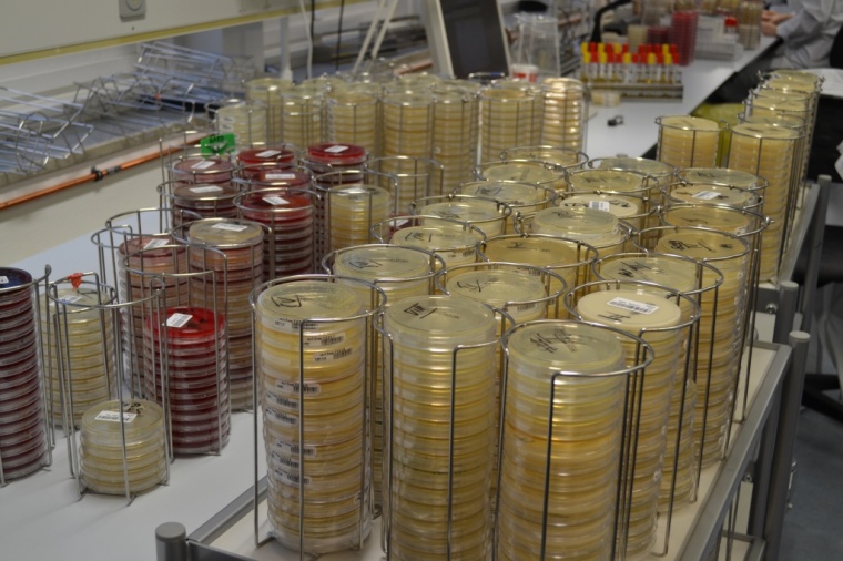 Wachstum von Erregern auf mikrobiologischen Platten im Asklepios-Großlabor...