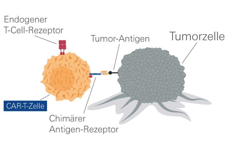 Durch einen Chimären Antigen-Rezeptor können T-Zellen Tumorzellen erkennen...