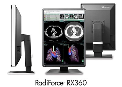 Der 3-Megapixel-Farbmonitor RadiForce RX360 eignet sich ideal für die Anzeige...