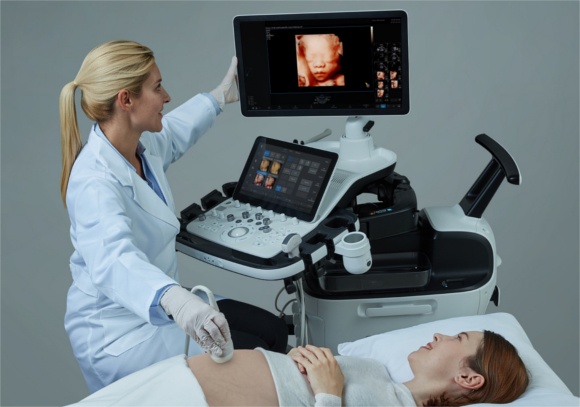 Neues Ultraschallsystem HERA W10. Foto: Samsung