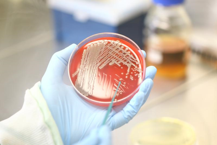 Staphylokokken-Kolonien auf bluthaltigem Nährboden. Foto: InfectoGnostics /...