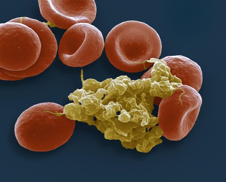 Erythrozyten und Thrombozyten. Foto: Steve Gschmeissner / Science Photo Library