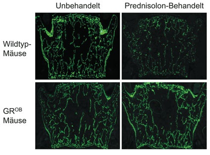 Die Aufnahmen am Fluoreszenzmikroskop zeigen mithilfe von Calcein die...